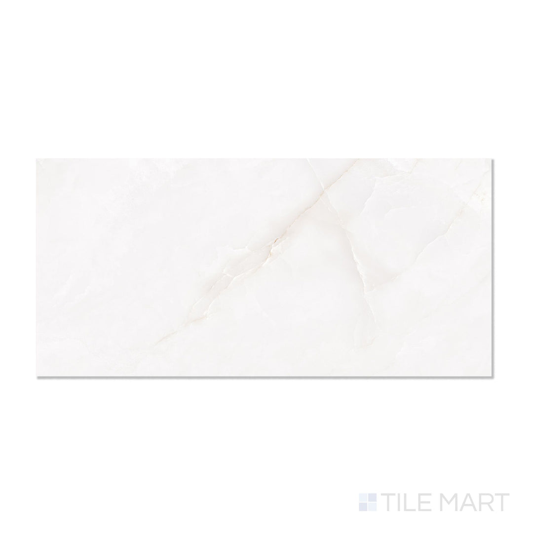 Roma Dozza Gold 24X48 Polished Porcelain Tile